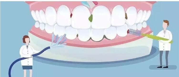关于洁牙您了解吗？
